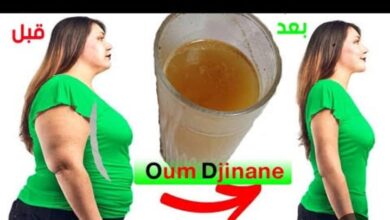 يتعرضن لمضاعفات..فتيات..يبحثن على (الاستايل) عند تاجرات يبعن الوهم 8 IMG 20250109 WA0274