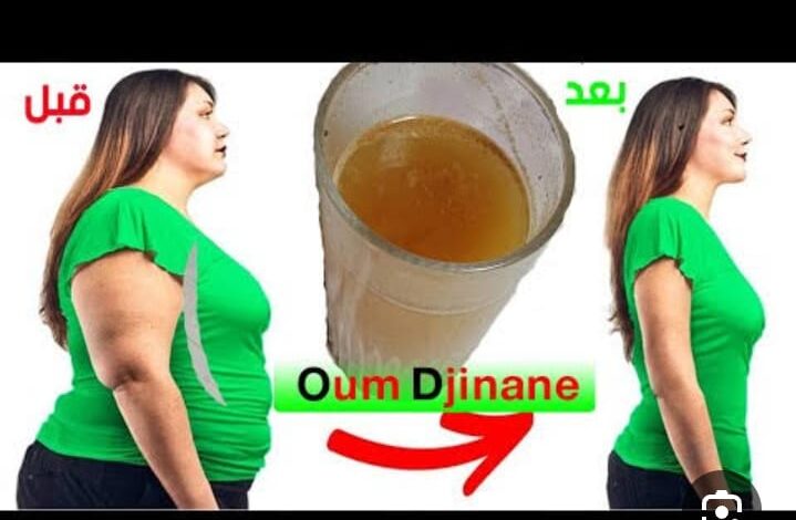 يتعرضن لمضاعفات..فتيات..يبحثن على (الاستايل) عند تاجرات يبعن الوهم 1 IMG 20250109 WA0274