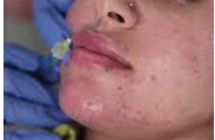 في مراكز نسائية..حروق وتشوهات بدل التجميل 1 IMG 20250122 WA0000