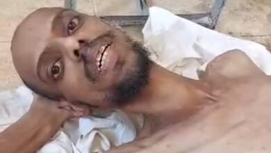 خطوات مهمة لإعادة صحة الأسرى المحررين 7 IMG 20250402 WA0162