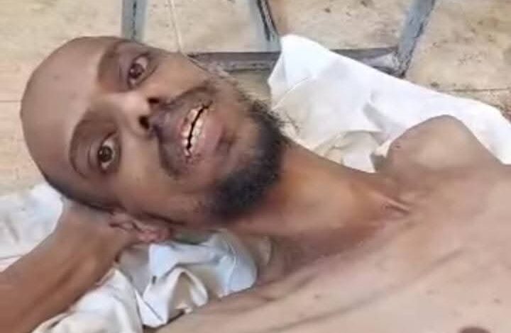 خطوات مهمة لإعادة صحة الأسرى المحررين 1 IMG 20250402 WA0162
