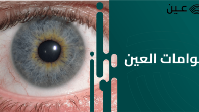 معلومات مهمة قد لا تعرفها..ذبابة العين الطائرة..ما هي ..أسباب ظهورها 10 df18f0f8 6640 4c59 a272 b7b2bc2060b8 1000x509.375 z3PBvbJEEarFpI1U1oEWFX4rTLoBZvh3lizPb7gq